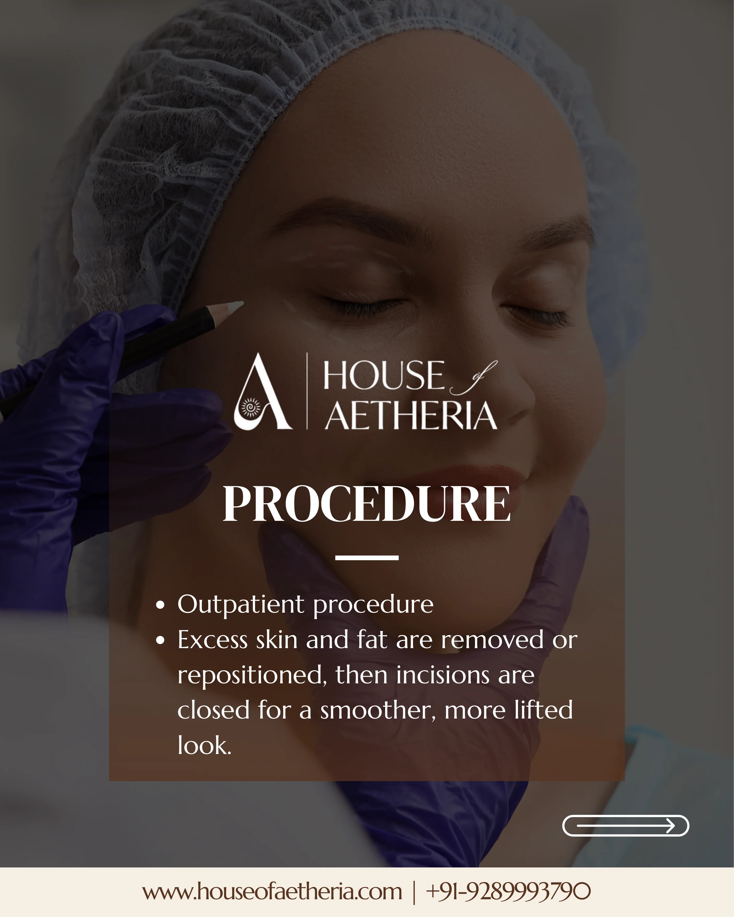 Blepharoplasty procedure overview at House of Aetheria, Gurugram