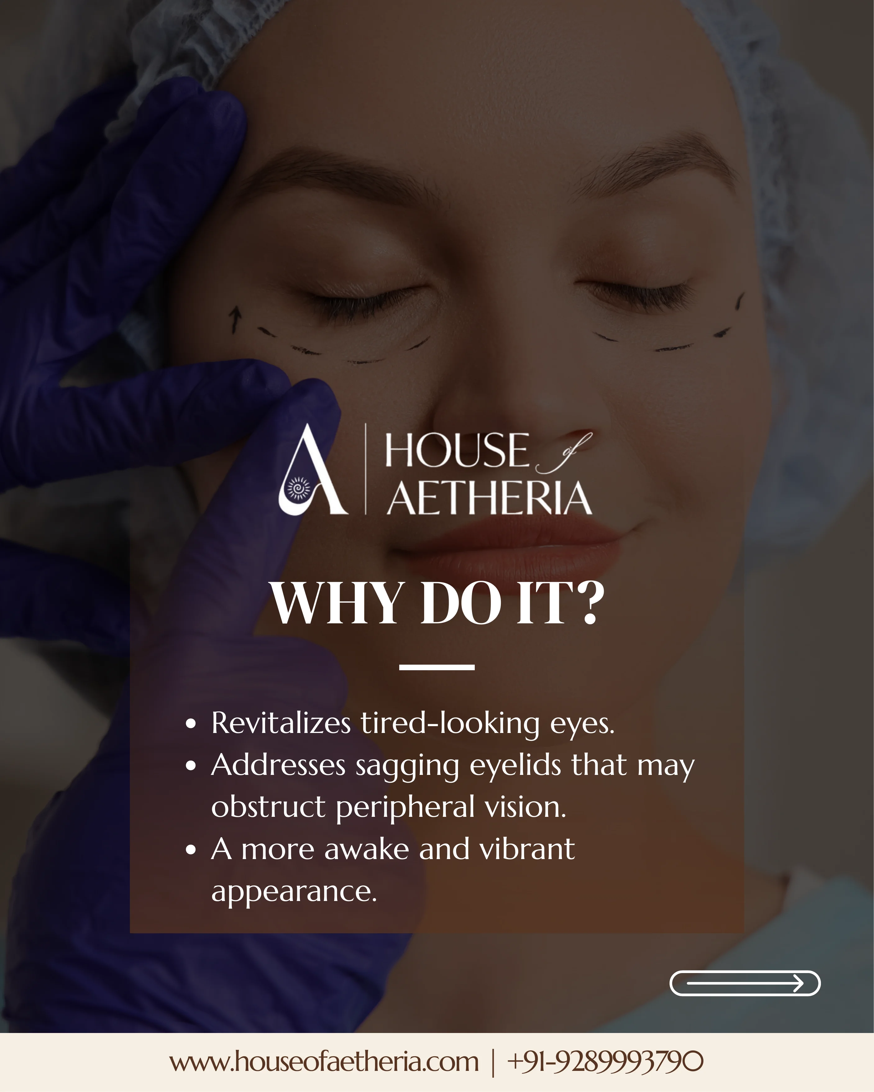 Why choose blepharoplasty — revitalising tired eyes at House of Aetheria, Gurugram