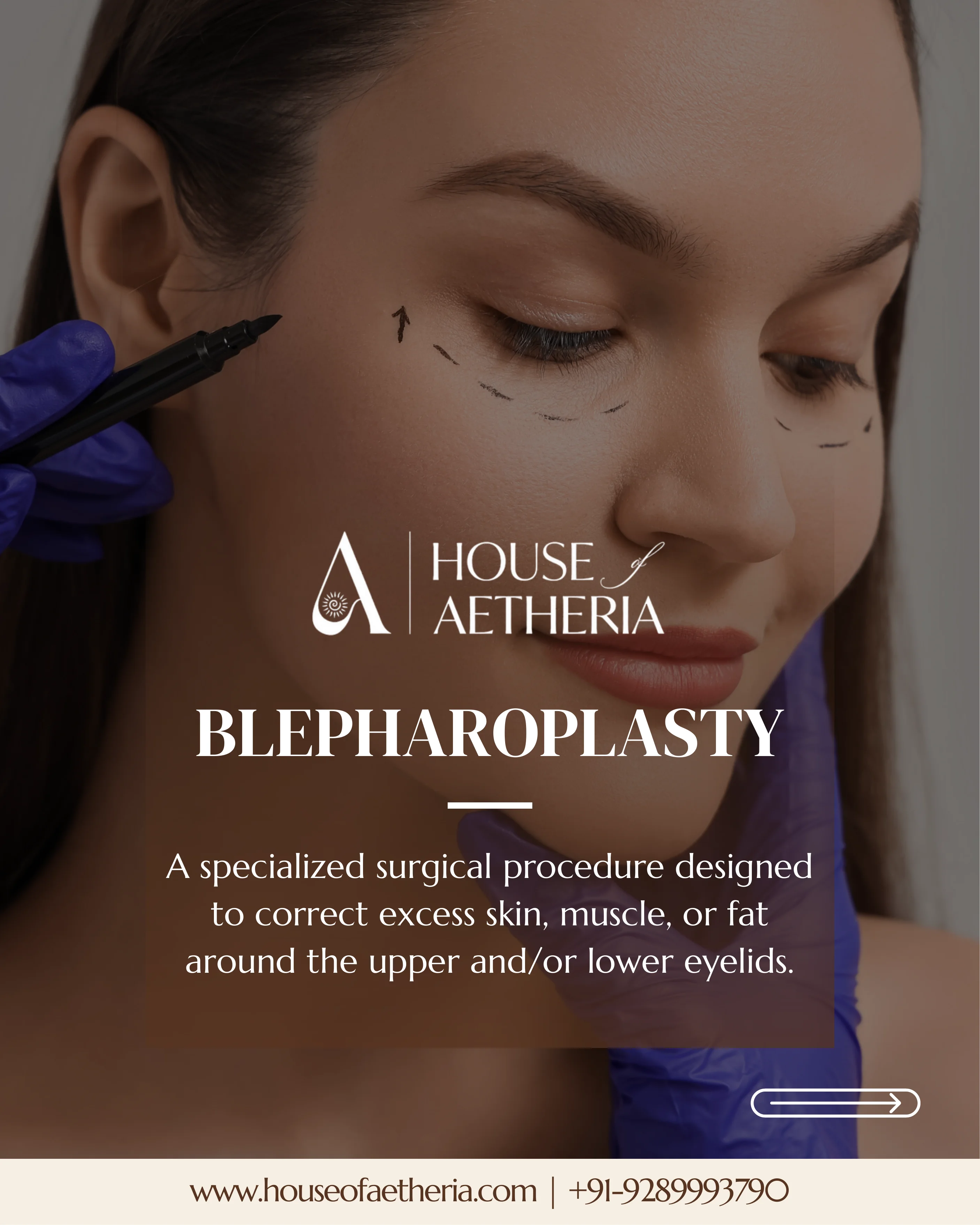 Blepharoplasty eyelid surgery consultation at House of Aetheria, Gurugram