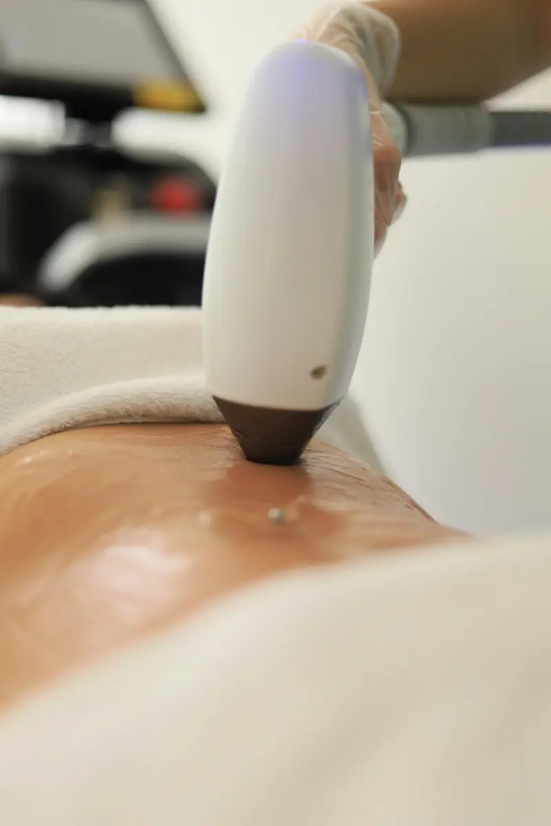 Stomach laser hair removal — House of Aetheria