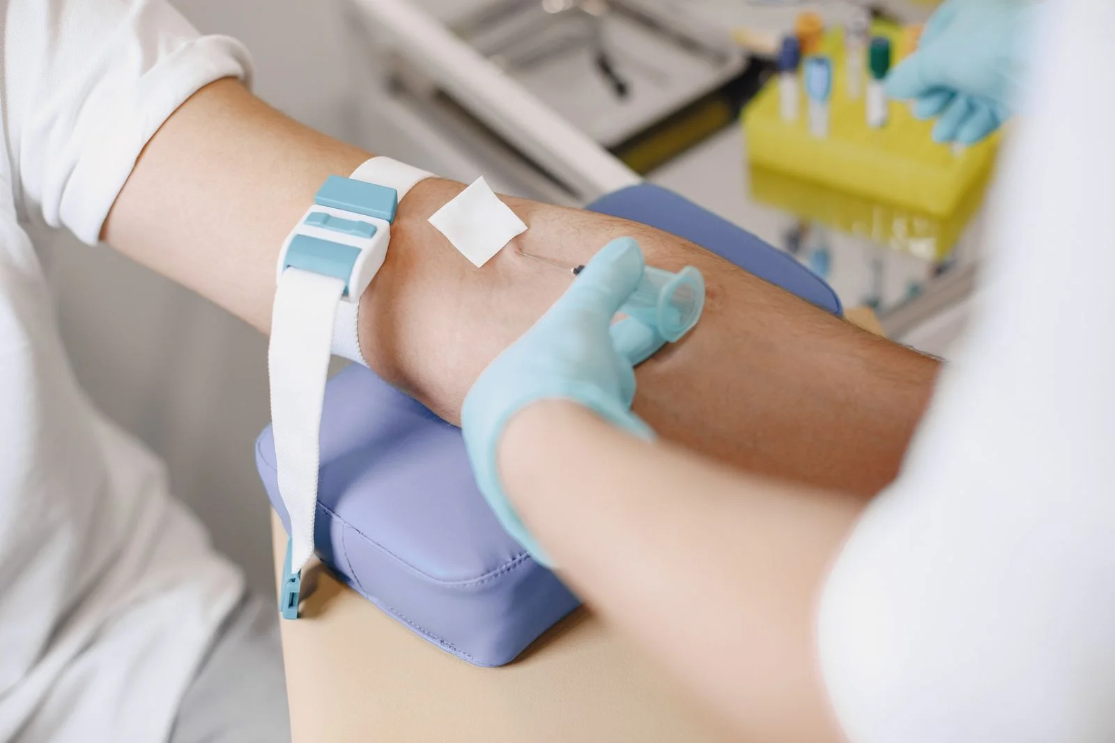 PRP vampire facial treatment at House of Aetheria, Gurugram